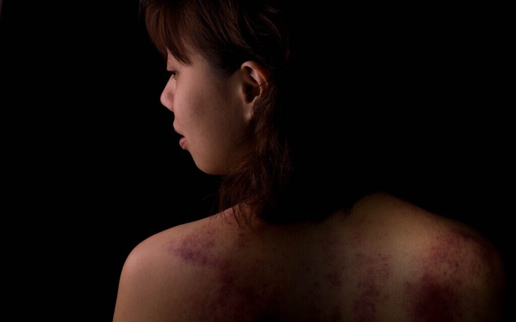 The domestic violence spike on New Year’s: still, not enough is being done